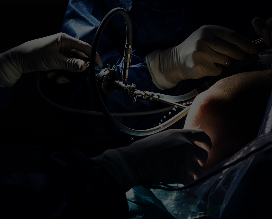 관절 내시경 이미지