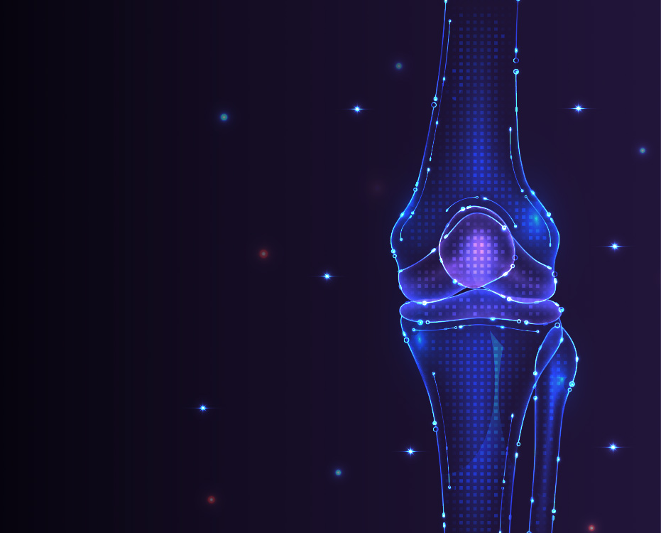 인공 관절 이미지