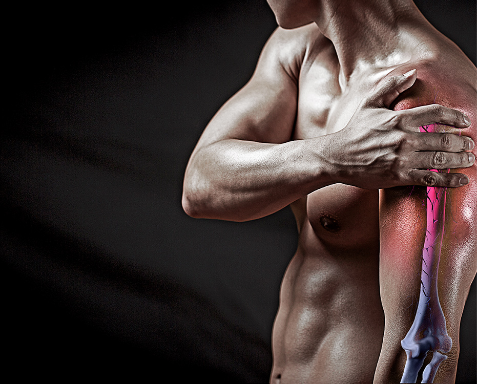 외상 골절 이미지