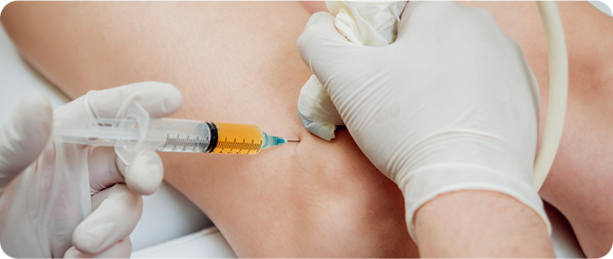 재생주사치료 치료 사진