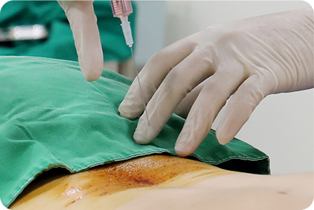 진단 및 시술 부위 확인하는 사진