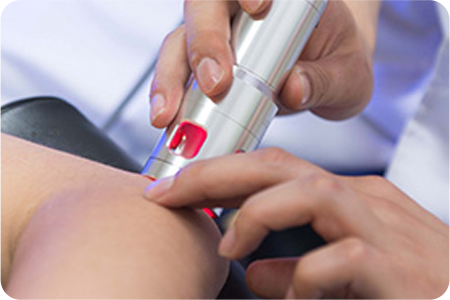 레이저 치료 사진