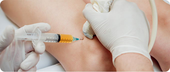 재생주사치료 사진