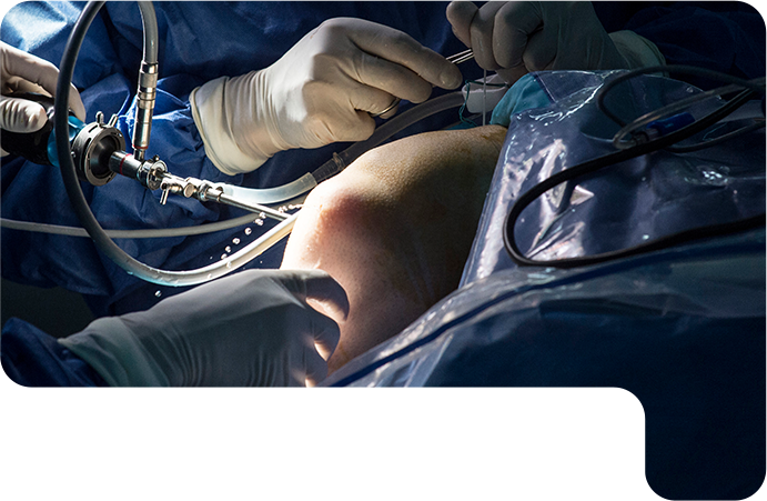 최소절개·최소침습 이미지